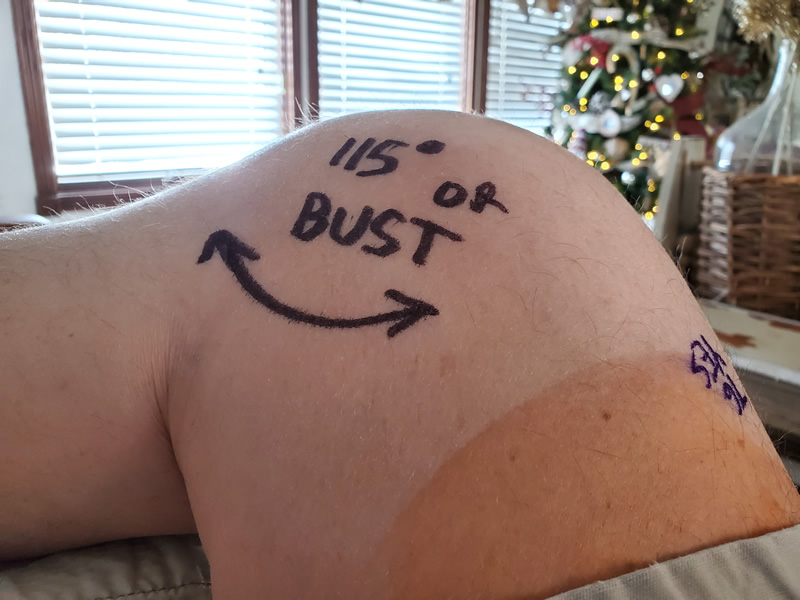 Message to bend my knee to 115 degrees for my doctor when I had my second knee manipulation surgery.